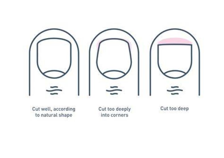 How often should you cut your toenails?