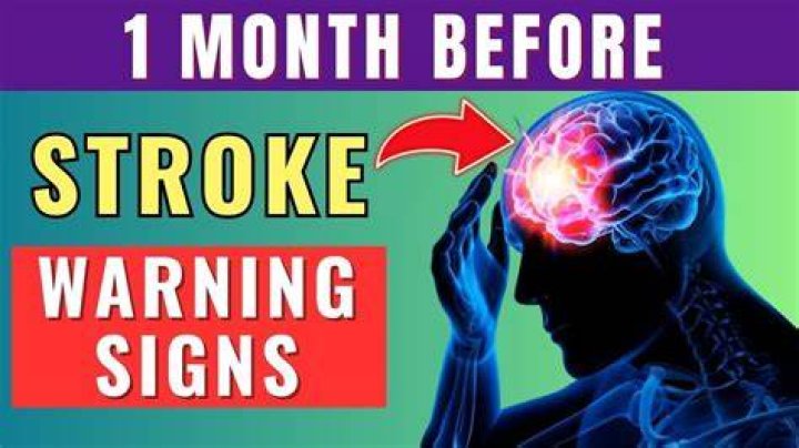 What are the warning signs days before a stroke?