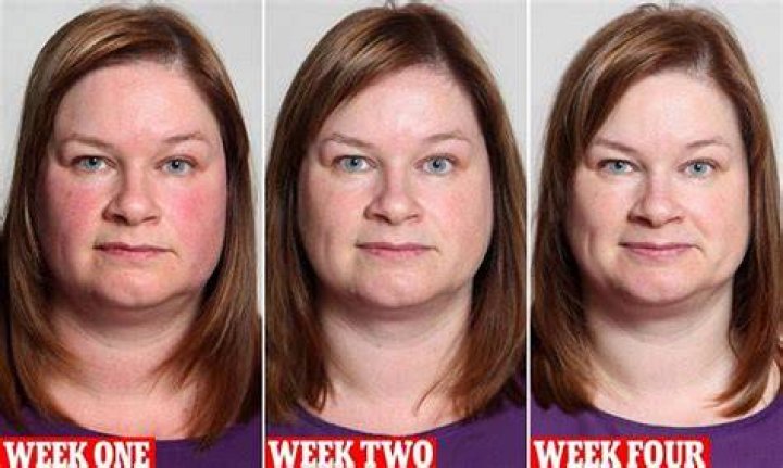 Will my face change if I quit alcohol?